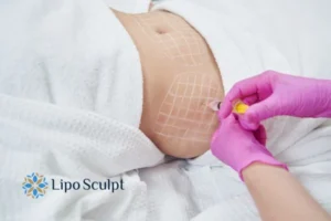 Are The Results From Aqualyx Permanent? 1 Do you want to know how long Aqualyx Bridgnorth results last?