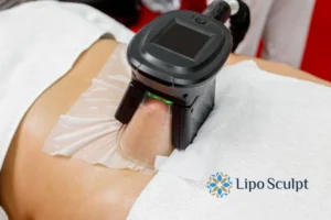 Does Fat Freezing At Home Work? 3 Fat freezing at home from Lipo Sculpt Bridgnorth